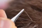 Plucking Gray Hair